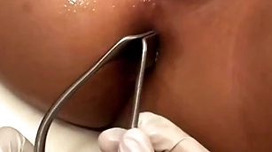 Asian patient penetrated in anal chasm at the end of one's tether stud in man of the cloth