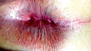Bore plus anus closeup